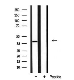 Invitrogen DOK4 Polyclonal Antibody 100 &mu;L | Buy Online | Invitrogen&trade; | Fisher Scientific