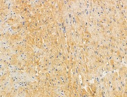 Invitrogen SLK Polyclonal Antibody 100 &mu;L | Buy Online | Invitrogen&trade; | Fisher Scientific