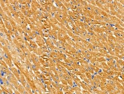 Invitrogen SLK Polyclonal Antibody 100 &mu;L | Buy Online | Invitrogen&trade; | Fisher Scientific
