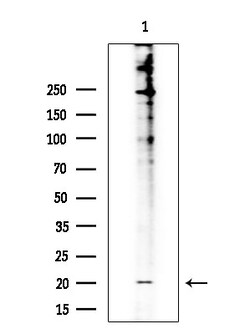 Invitrogen DUSP22 Polyclonal Antibody 100 &mu;L; Unconjugated:Antibodies,