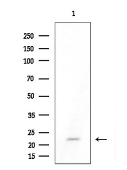 Invitrogen DUSP22 Polyclonal Antibody 100 &mu;L; Unconjugated:Antibodies,