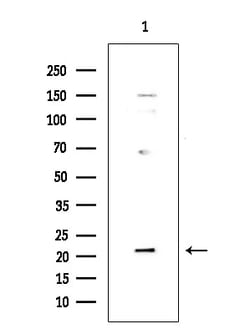 Invitrogen DUSP22 Polyclonal Antibody 100 &mu;L; Unconjugated:Antibodies,