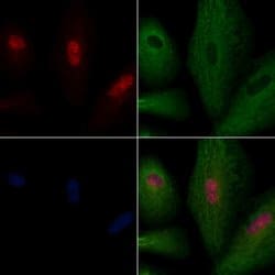 Invitrogen ASF1A Polyclonal Antibody 100 &mu;L; Unconjugated:Antibodies,