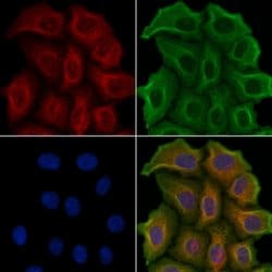 Invitrogen HTR2C Polyclonal Antibody 100 &mu;L; Unconjugated:Antibodies,