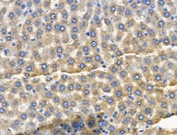 Invitrogen CYP2E1 Polyclonal Antibody 100 &mu;L; Unconjugated:Antibodies,