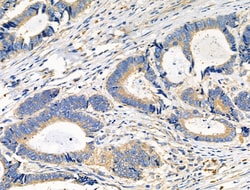 Invitrogen RPS4X Polyclonal Antibody 100 &mu;L; Unconjugated:Antibodies,