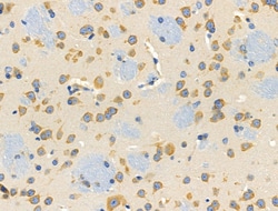 Invitrogen RPS4X Polyclonal Antibody 100 &mu;L; Unconjugated:Antibodies,