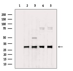Invitrogen RPS4X Polyclonal Antibody 100 &mu;L; Unconjugated:Antibodies,