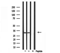 Invitrogen RPS4X Polyclonal Antibody 100 &mu;L; Unconjugated:Antibodies,