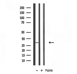 Invitrogen RPS4X Polyclonal Antibody 100 &mu;L; Unconjugated:Antibodies,