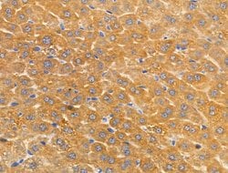 Invitrogen Arylsulfatase A Polyclonal Antibody 100 &mu;L; Unconjugated:Antibodies,