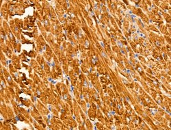 Invitrogen Arylsulfatase A Polyclonal Antibody 100 &mu;L; Unconjugated:Antibodies,