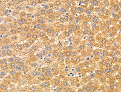 Invitrogen Arylsulfatase A Polyclonal Antibody 100 &mu;L; Unconjugated:Antibodies,