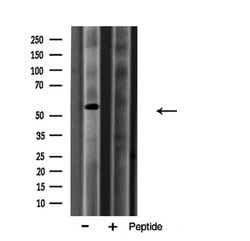 Invitrogen Arylsulfatase A Polyclonal Antibody 100 &mu;L; Unconjugated:Antibodies,