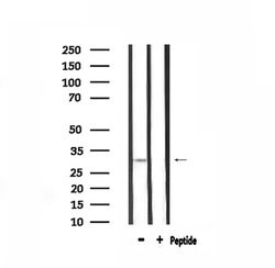 Invitrogen Calponin 2 Polyclonal Antibody 100 &mu;L; Unconjugated:Antibodies,