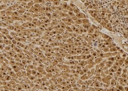 Invitrogen C1QBP Polyclonal Antibody 100 &mu;L | Buy Online | Invitrogen&trade; | Fisher Scientific