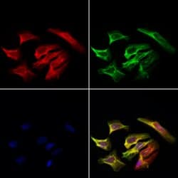 Invitrogen eIF3k Polyclonal Antibody 100 &mu;L; Unconjugated:Antibodies,