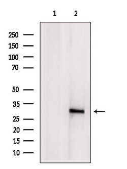 Invitrogen eIF3k Polyclonal Antibody 100 &mu;L; Unconjugated:Antibodies,