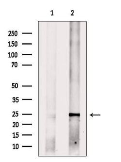 Invitrogen MED18 Polyclonal Antibody 100 &mu;L | Buy Online | Invitrogen&trade; | Fisher Scientific