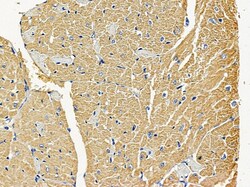 Invitrogen MRPS22 Polyclonal Antibody 100 &mu;L; Unconjugated:Antibodies,