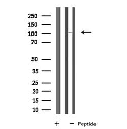 Invitrogen SP100 Polyclonal Antibody 100 μL; Unconjugated:Antibodies,