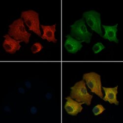 Septin-14 Polyclonal Antibody, Invitrogen 100 &mu;L | Buy Online | Invitrogen | Fisher Scientific
