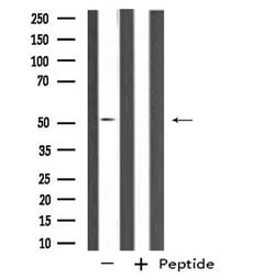 Septin-14 Polyclonal Antibody, Invitrogen 100 &mu;L | Buy Online | Invitrogen | Fisher Scientific
