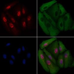 Invitrogen RAD23B Polyclonal Antibody 100 μL; Unconjugated:Antibodies,