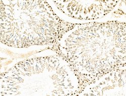 Invitrogen RAD23B Polyclonal Antibody 100 μL; Unconjugated:Antibodies,