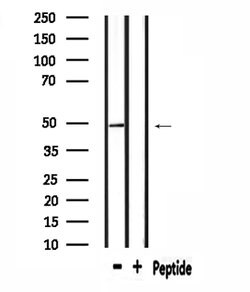 Invitrogen RAD23B Polyclonal Antibody 100 μL; Unconjugated:Antibodies,