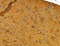 Invitrogen GPR101 Polyclonal Antibody 100 &mu;L; Unconjugated:Antibodies,