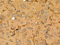Invitrogen GPR101 Polyclonal Antibody 100 &mu;L; Unconjugated:Antibodies,