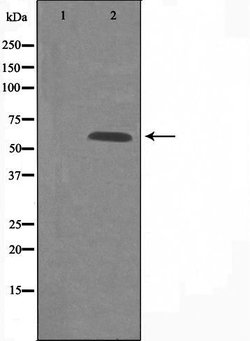 Invitrogen GPR101 Polyclonal Antibody 100 &mu;L; Unconjugated:Antibodies,