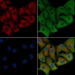 Invitrogen GIPR Polyclonal Antibody 100 &mu;L; Unconjugated:Antibodies,