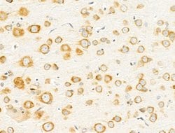 Invitrogen GIPR Polyclonal Antibody 100 &mu;L; Unconjugated:Antibodies,