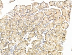 Invitrogen GIPR Polyclonal Antibody 100 &mu;L; Unconjugated:Antibodies,