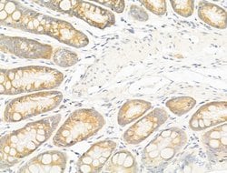 Invitrogen GIPR Polyclonal Antibody 100 &mu;L; Unconjugated:Antibodies,