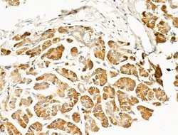 Invitrogen GIPR Polyclonal Antibody 100 &mu;L; Unconjugated:Antibodies,