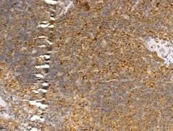 Invitrogen GIPR Polyclonal Antibody 100 &mu;L; Unconjugated:Antibodies,
