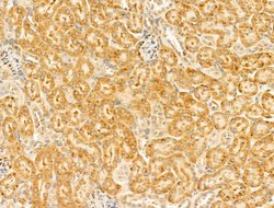 Invitrogen GIPR Polyclonal Antibody 100 &mu;L; Unconjugated:Antibodies,