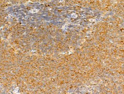 Invitrogen GIPR Polyclonal Antibody 100 &mu;L; Unconjugated:Antibodies,