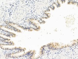 Invitrogen GIPR Polyclonal Antibody 100 &mu;L; Unconjugated:Antibodies,