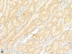 Invitrogen GIPR Polyclonal Antibody 100 &mu;L; Unconjugated:Antibodies,