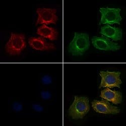 Invitrogen Arp3 Polyclonal Antibody 100 &mu;L; Unconjugated:Antibodies,