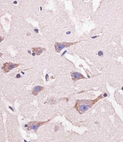 Invitrogen Nestin Polyclonal Antibody 400 &mu;L | Buy Online | Invitrogen&trade; | Fisher Scientific