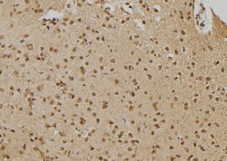 Invitrogen PTPN22 Polyclonal Antibody 100 &mu;L; Unconjugated:Antibodies,
