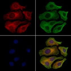 Invitrogen BCAM Polyclonal Antibody 100 &mu;L; Unconjugated:Antibodies,