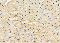 Invitrogen EVL Polyclonal Antibody 100 &mu;L; Unconjugated:Antibodies,