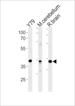 Invitrogen NeuroD1 Polyclonal Antibody 400 &mu;L | Buy Online | Invitrogen&trade; | Fisher Scientific