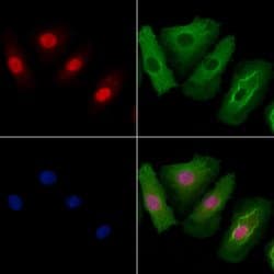 Invitrogen ELF5 Polyclonal Antibody 100 &mu;L; Unconjugated:Antibodies,